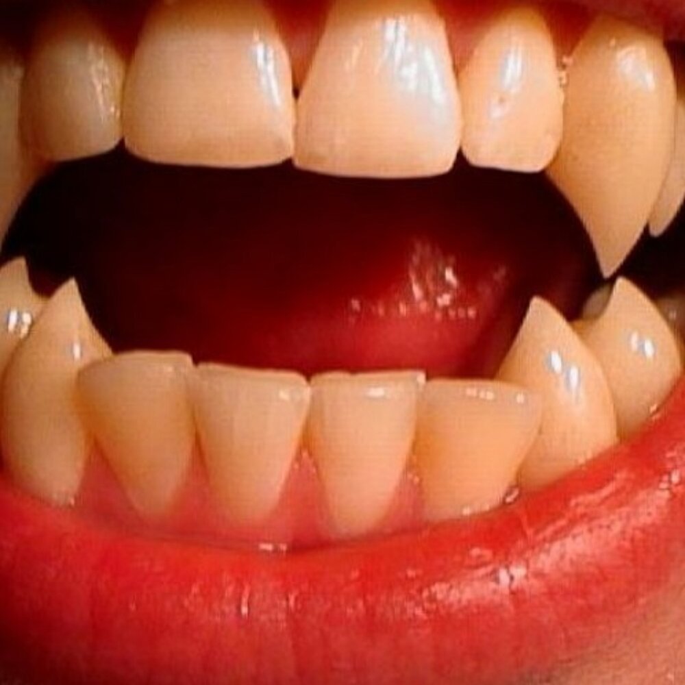 как нарасти клыки