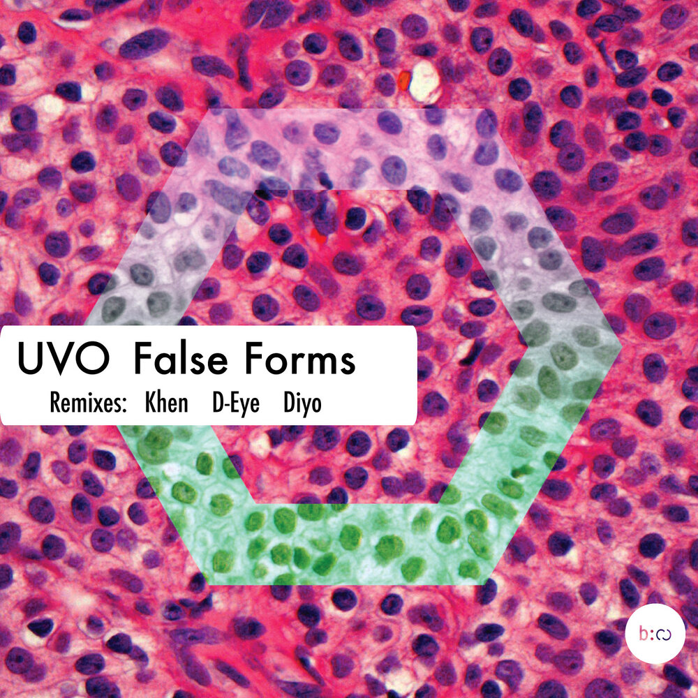 Listening form 8. UVO.