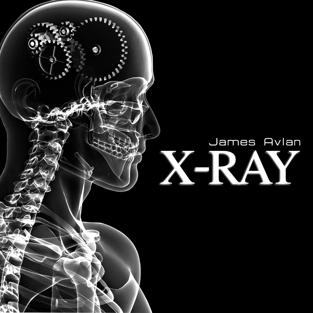 James ray. X-ray Extensions. Ray слушать. Xray extension