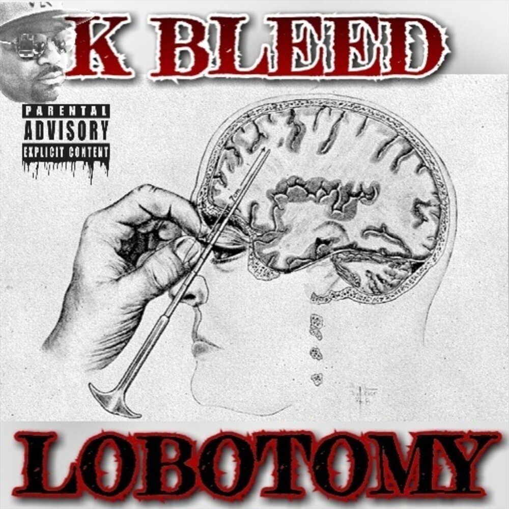 Malkuth lobotomy corporation art. Тиферет сефира lobotomy. Лоботомия корпорейшн 2. Префронтальная лоботомия. Малхут лоботомия.