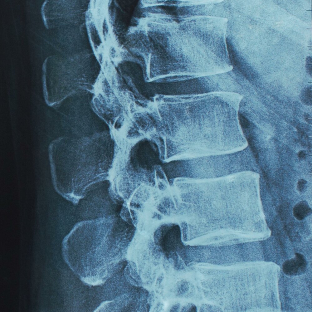Рассмотрите рентгенограмму с изображением позвоночника человека