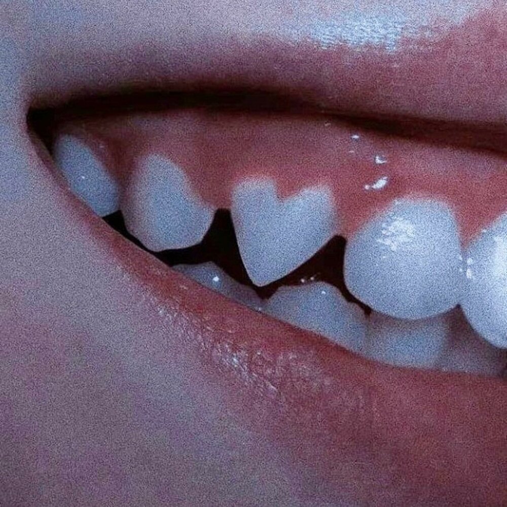 фото острых зубов