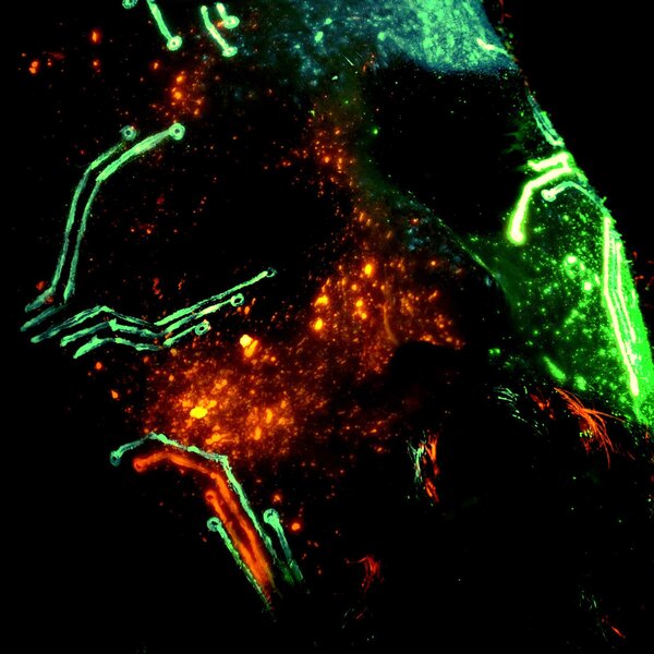 track-cover