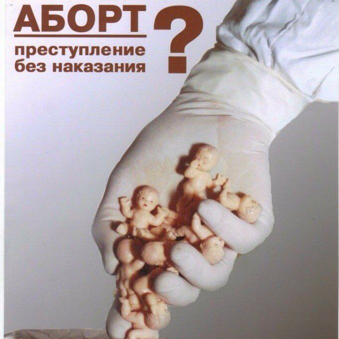 Аборт как выглядит ребенок