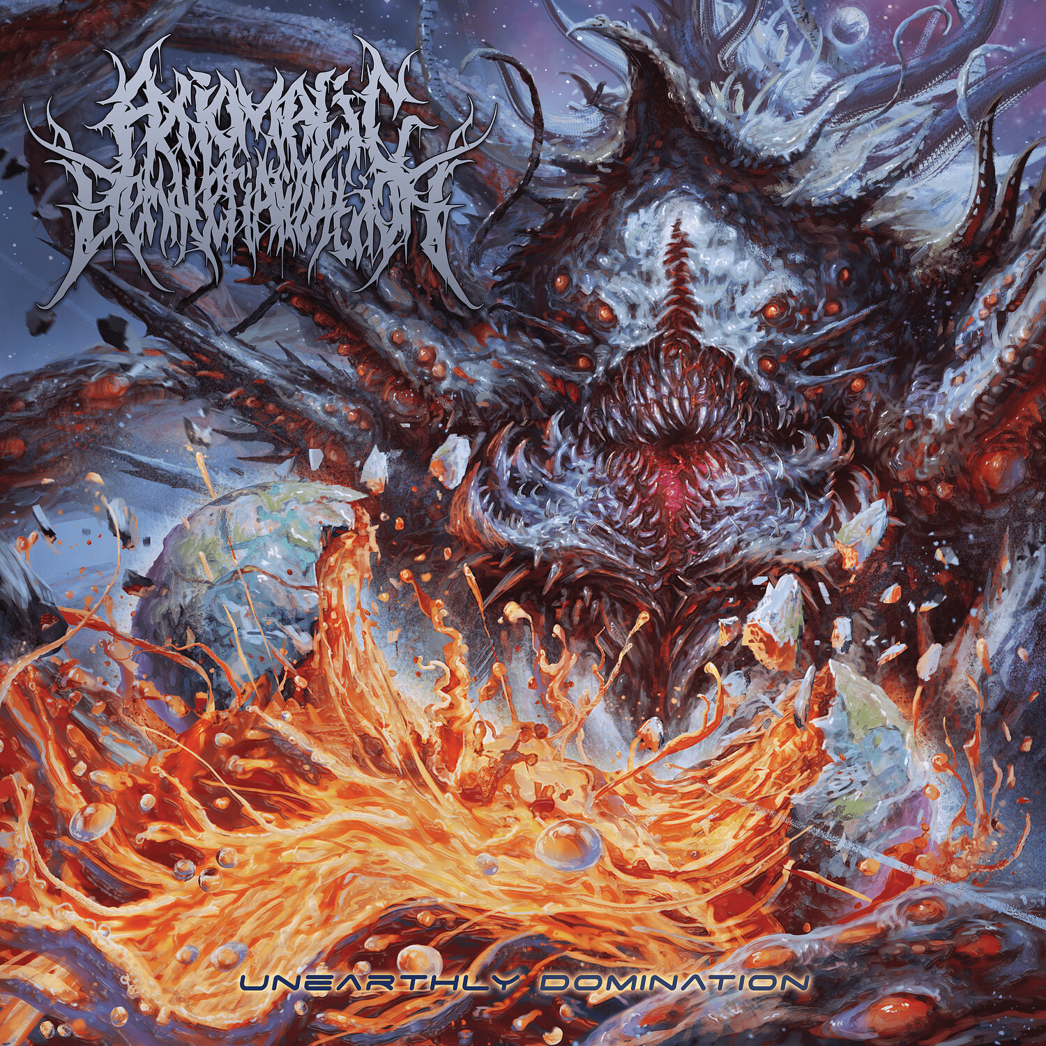 Organectomy