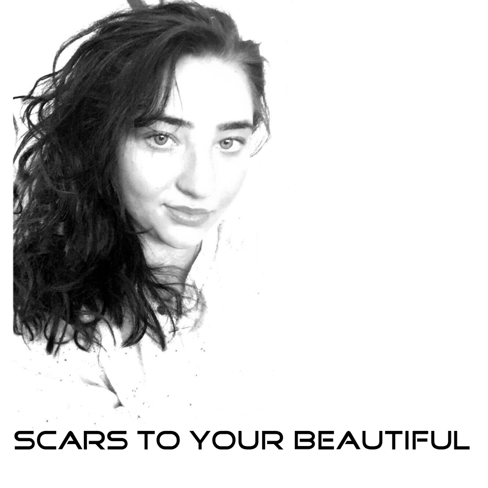 Your beautiful. Your beautiful исполнитель. Scars to your beautiful. No scars to your beautiful. Scars to your beautiful клип.