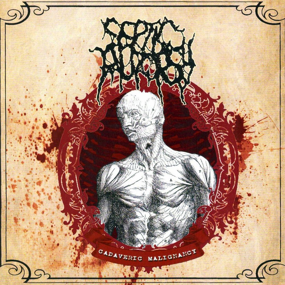 Decay in Buried Bodies Septic Autopsy слушать онлайн на Яндекс Музыке.